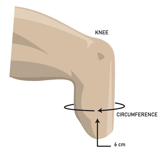 Manchon en silicone EasyFlex, ALPS®